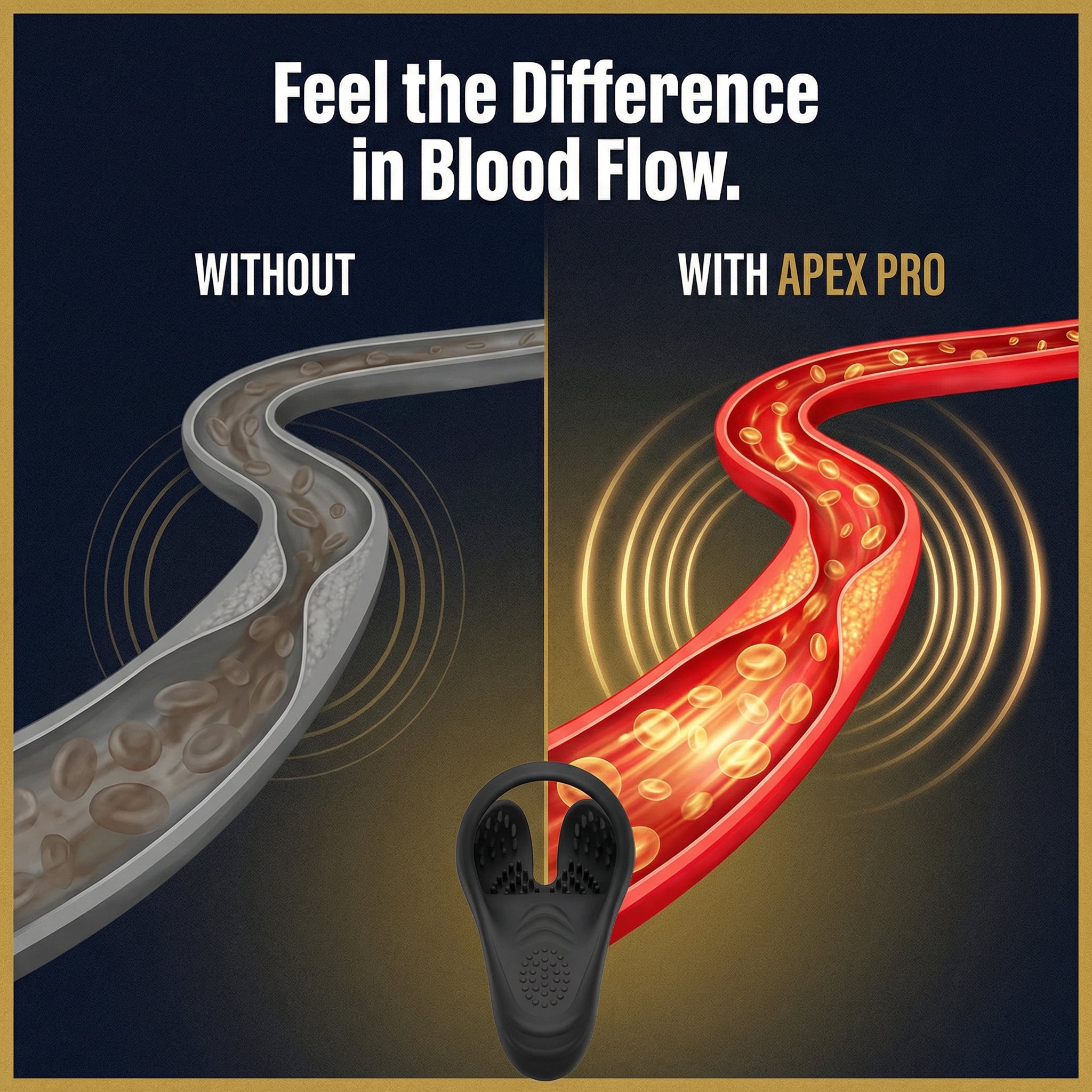 Apex-Pro
